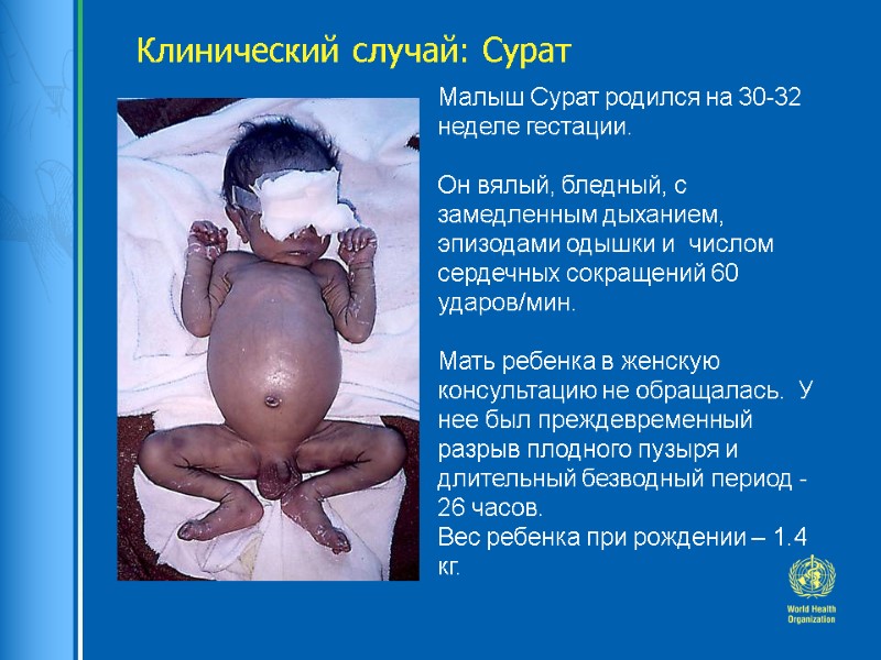 Малыш Сурат родился на 30-32 неделе гестации.  Он вялый, бледный, с замедленным дыханием,